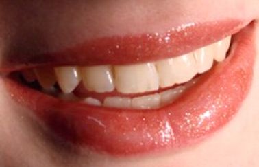 Wir helfen zu gesundem Atem