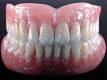 Vollprothese - für den unbezahnten Kiefer Vollprothese - für den unbezahnten Kiefer